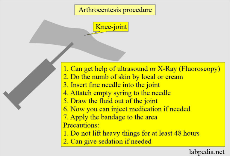 Fluid Analysis Part Synovial Fluid Analysis Procedure For