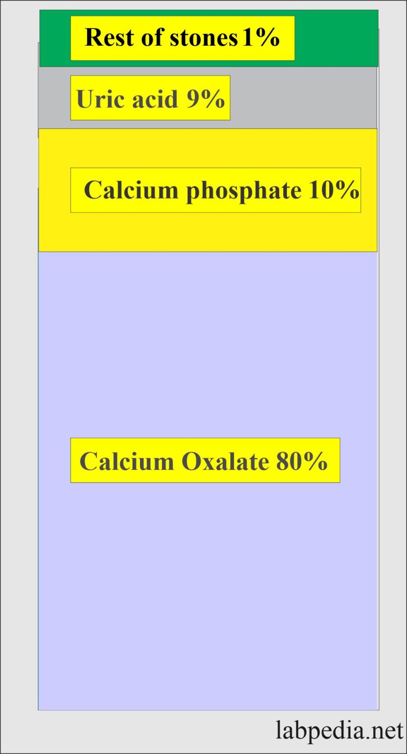 Renal Stone Analysis Urinary Stones Analysis Renal Calculi