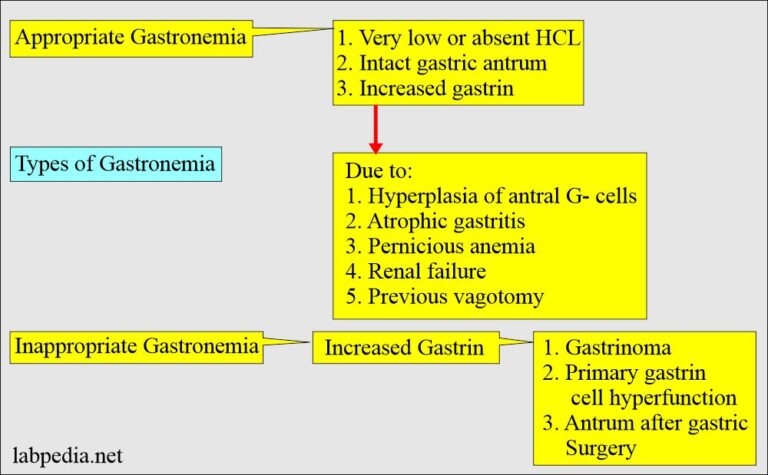 Zollinger Ellison Syndrome Gastrinoma