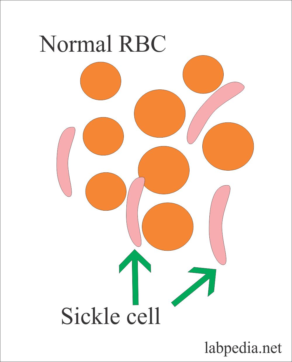 Anemia Types And Characteristic Finding Classification Of Anemias 7126