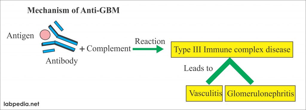 Anti-Glomerular basement membrane antibody (Anti-GBM antibody