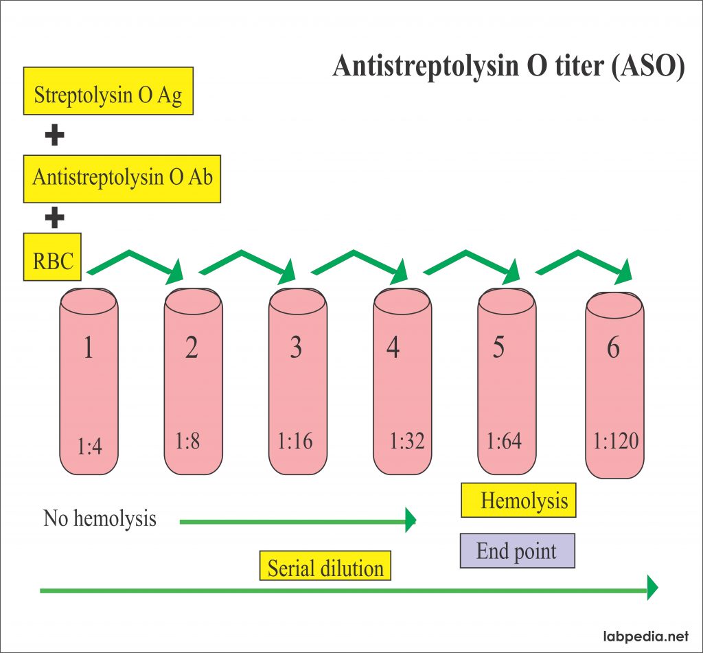 ASO Titer (Antistreptolysin O titer) - Labpedia.net