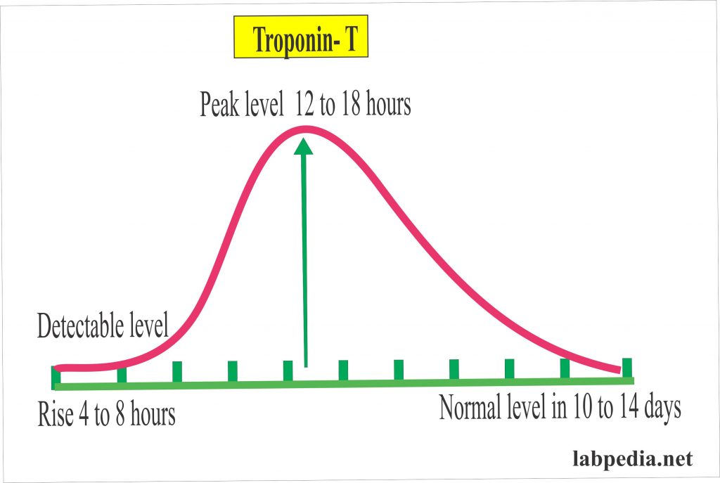 Cardiac Marker Part 1 Diagnosis Of Acute Myocardial Infarction Ami Labpedia Net