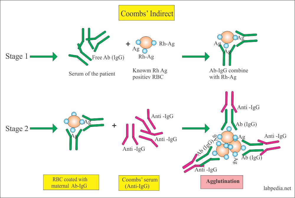 Coombs’ Test – Part 2 – Indirect, Anti-globulin indirect Sns-Brigh10