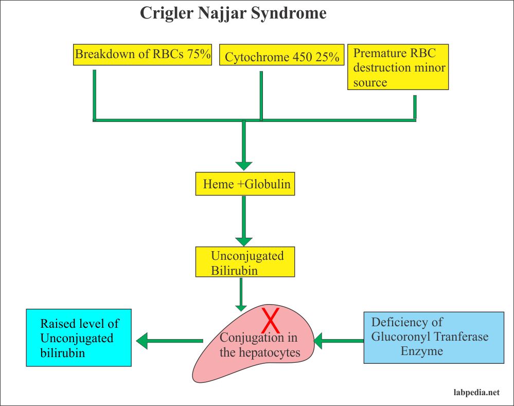 Crigler-Najjar Syndrome – Labpedia.net