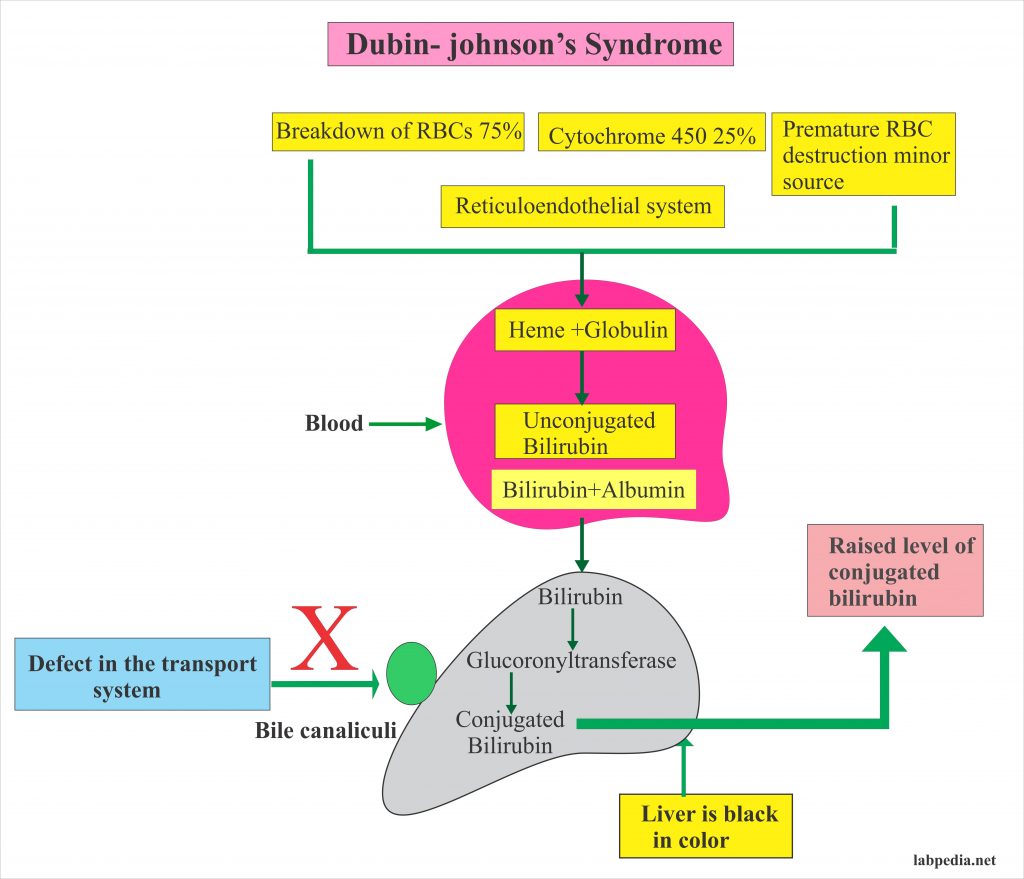 Dubin-Johnson Syndrome Diagnosis – Labpedia.net