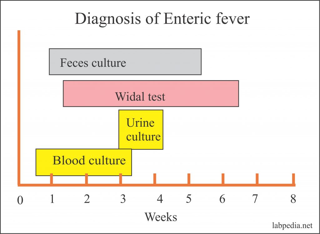 Enteric Fever Part 2 Typhoid Enteric Fever Diagnosis Widal Test Its Procedure And Interpretation Labpedia Net