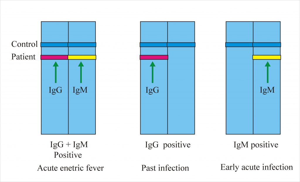 enteric-fever-part-4-typhidot-test-for-diagnosis-of-enteric-fever