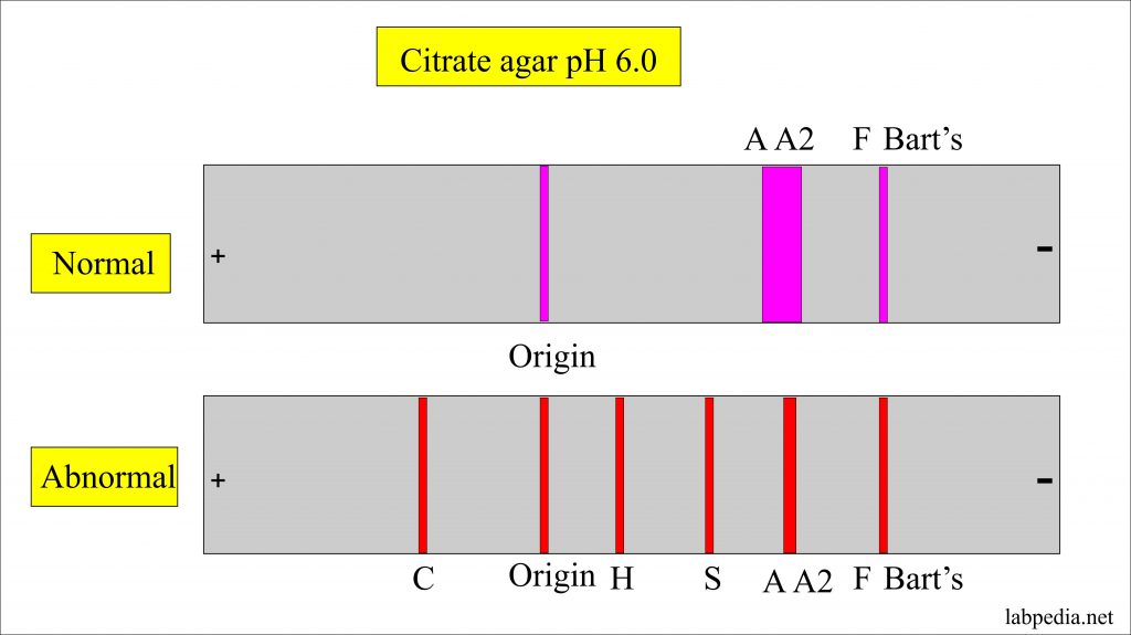 Hemoglobin Part 2 Hemoglobin Electrophoresis Hb Electrophoresis Labpedia Net