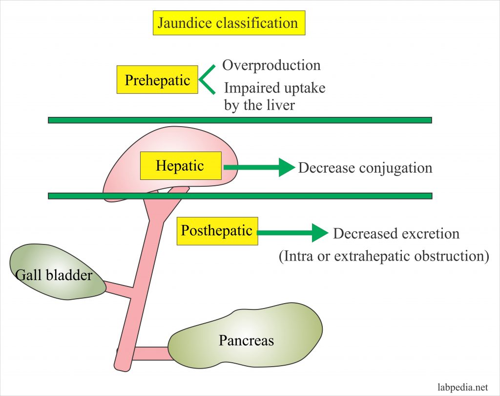 liver-function-tests-part-3-bilirubin-jaundice-and-liver-function