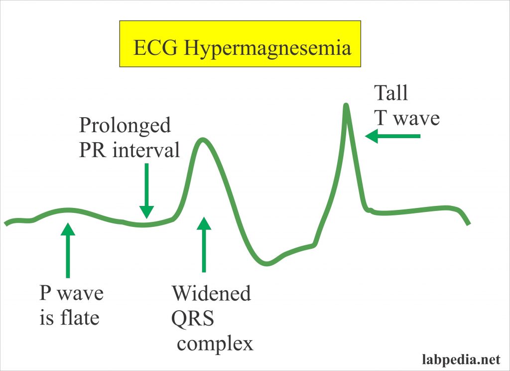 Magnesium Level Mg Labpedia Net