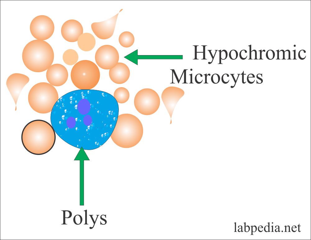 Concentración de la hemoglobina corpuscular media