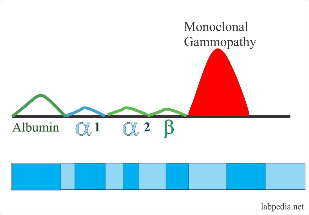 Protein Serum Electrophoresis (Total protein, albumin and globulin