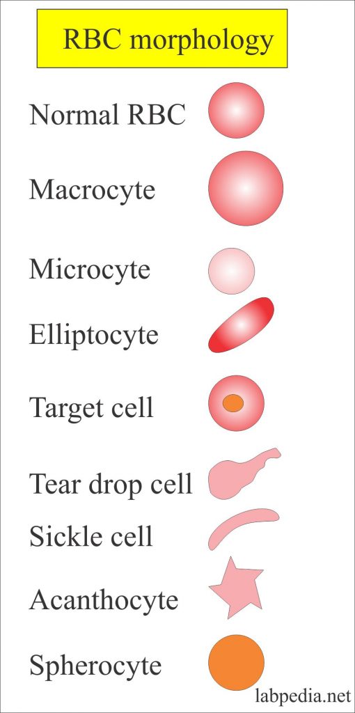 Red Blood Cell (RBC):- Part 5 – RBC Morphology Differential Diagnosis, and Interpretations