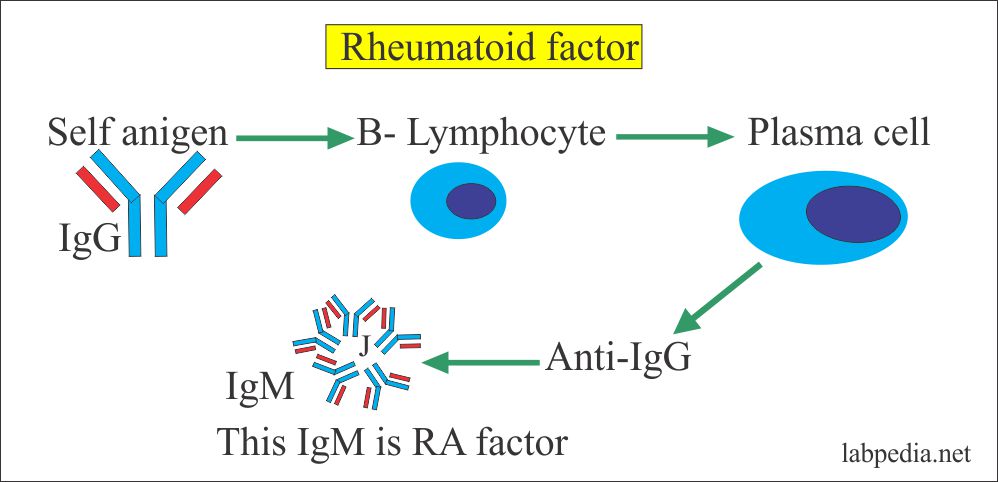 Rheumatoid Factor RF Rheumatoid Arthritis Factor RA Factor 