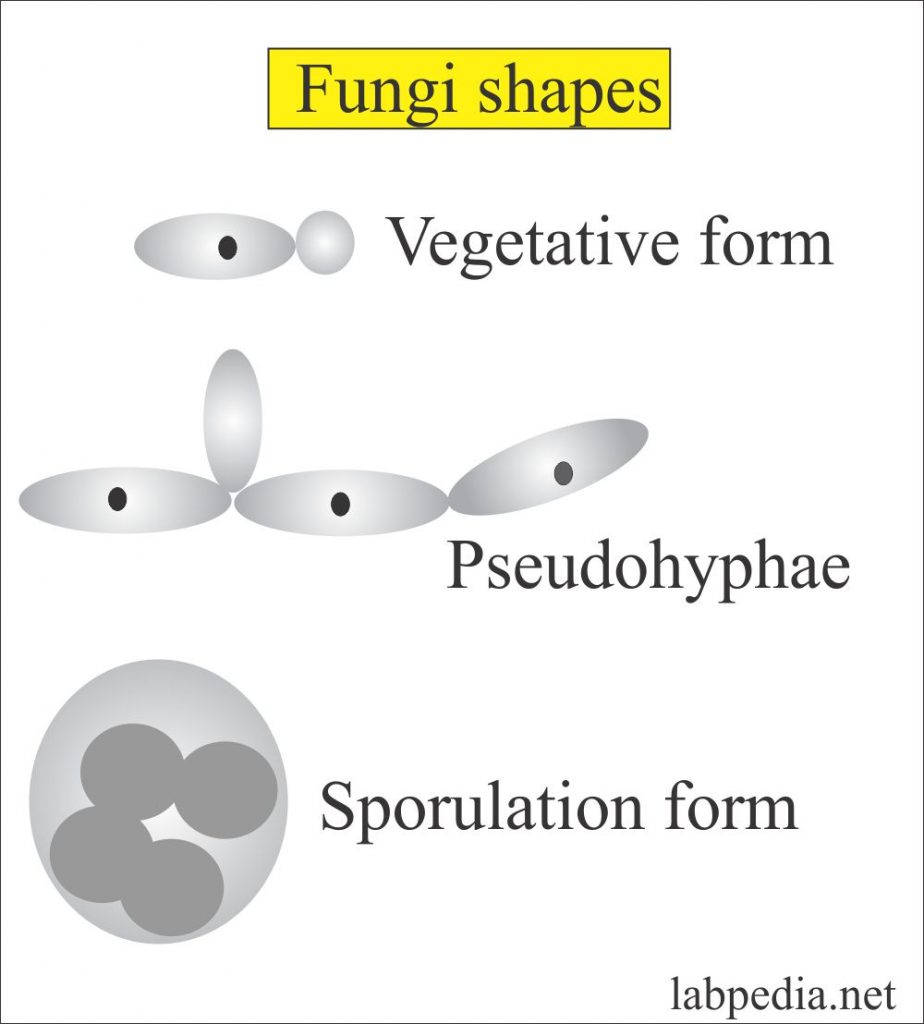 Sputum for fungi (Fungus, Yeast and Molds)