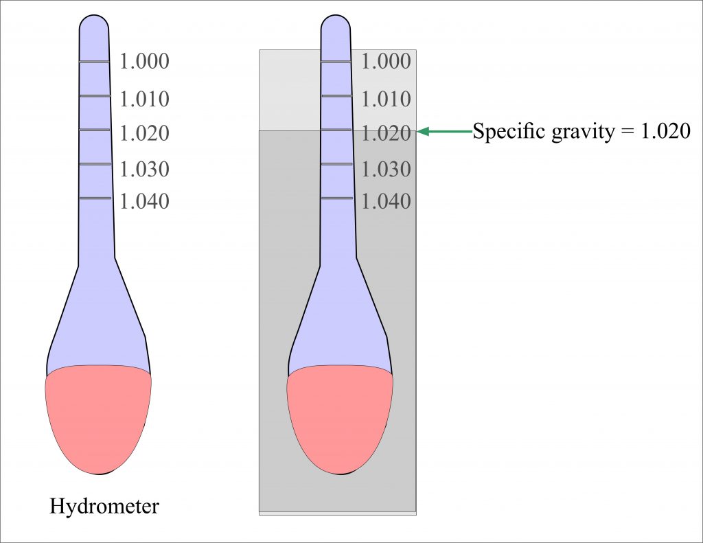 Urine For Specific Gravity and Its Significance
