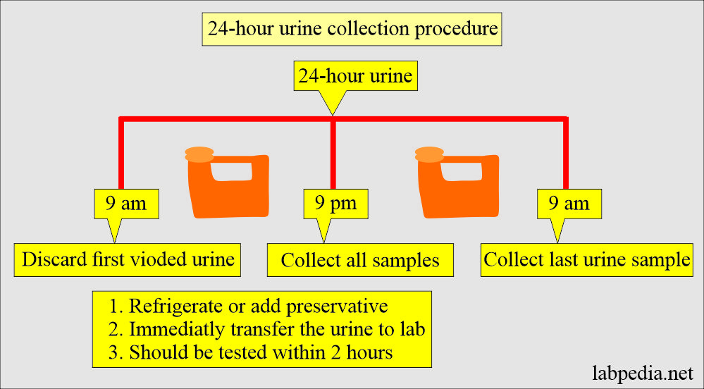 24-hour urine collection procedure