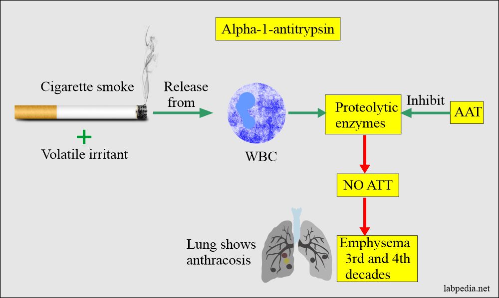 AAT and cigarette smoking leads to emphysema