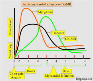 Cardiac marker:- Part 2 - CK-MB (Cardiac Enzyme) - Labpedia.net
