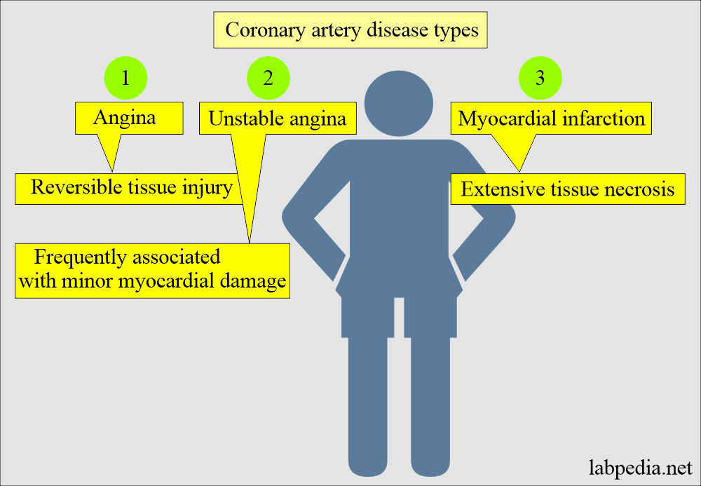Types of ischemic heart diseases