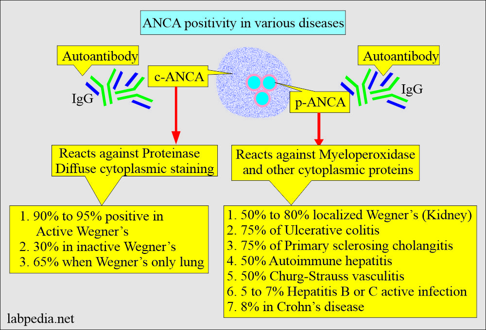 ANCA antibodies in various diseases