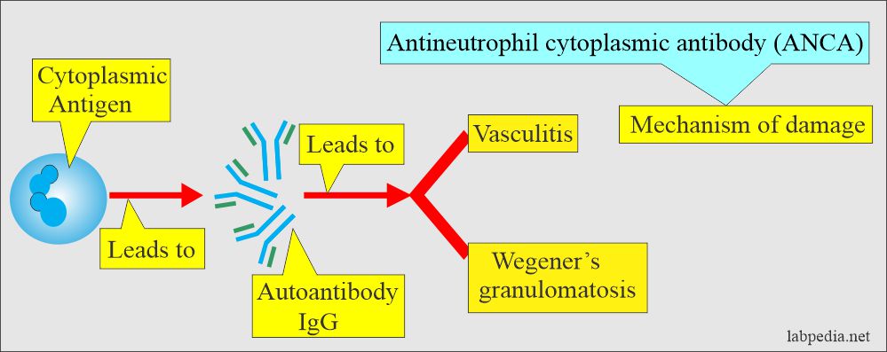 Antineutrophil cytoplasmic antibody (ANCA): ANCA mechanism for damage