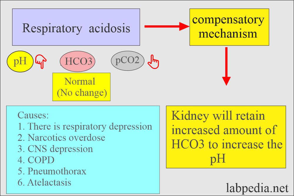 Acid-base balance: Respiratory acidosis