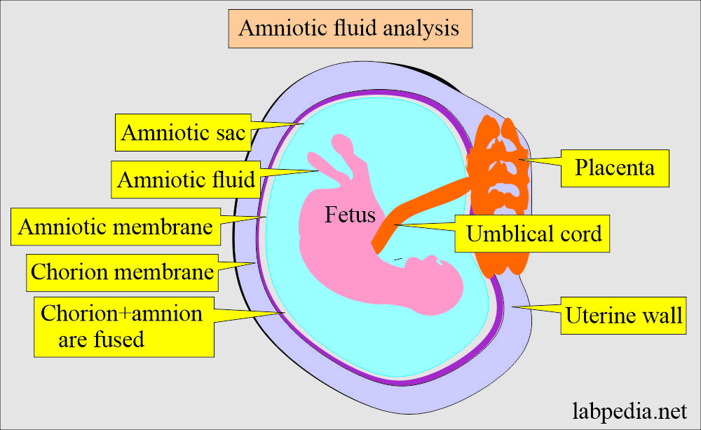 Fluid Analysis:- Part 5 – Amniotic fluid Examination (Amniocentesis), Normal and Abnormal Findings