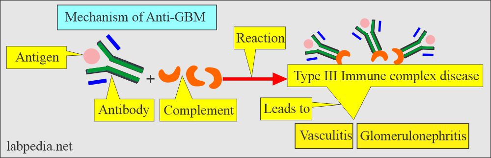 Mechanism of Anti-GBM
