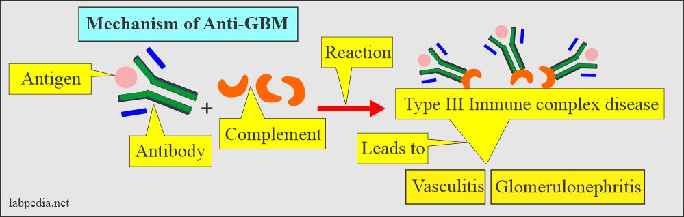 Anti-GBM type III reaction 