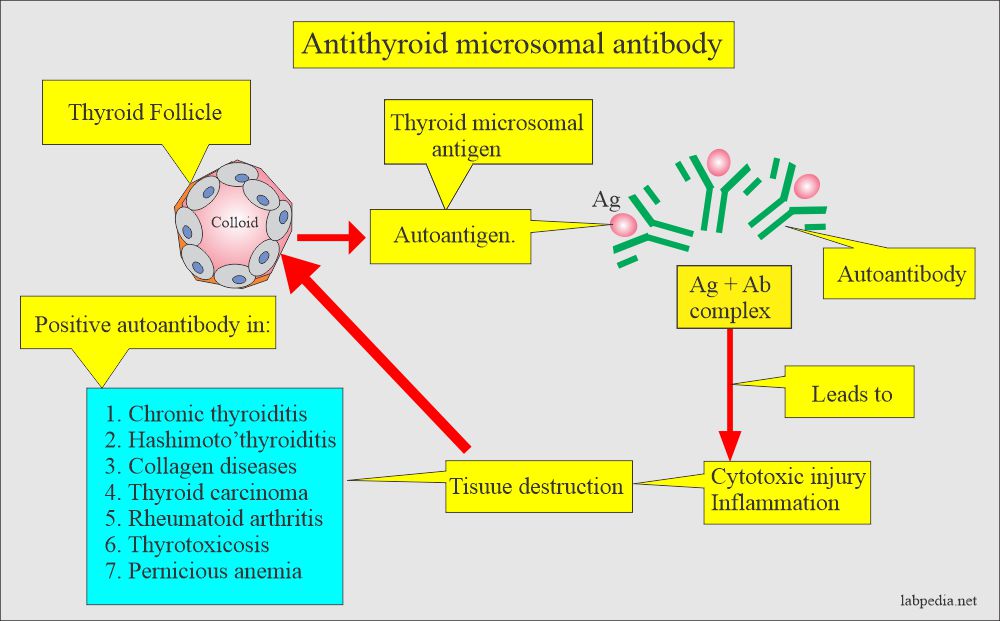 Anti-Thyroid Microsomal Antibody: Antimicrosomal antibody and its value in thyroid diseases