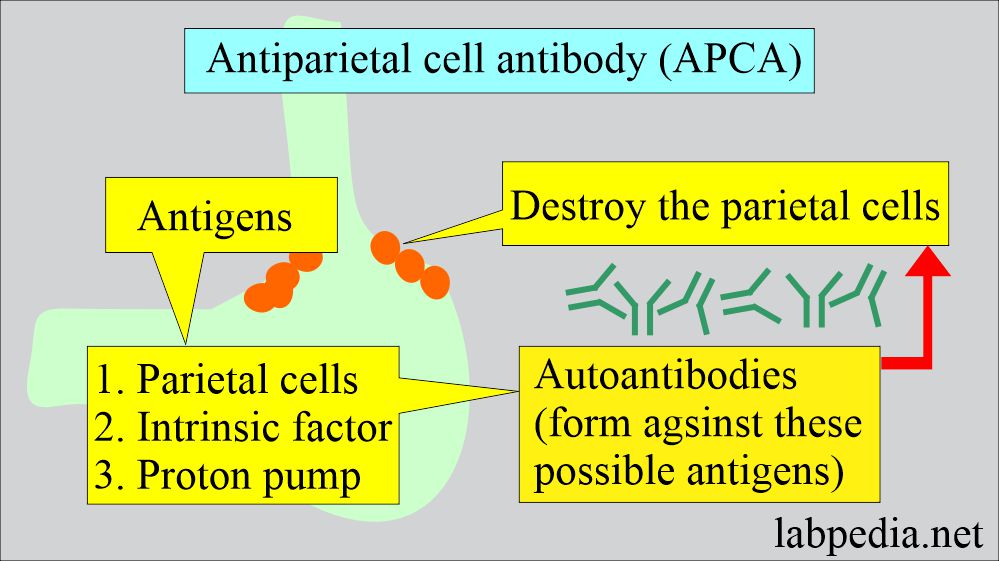 Antiparietal cell antibody (APCA)