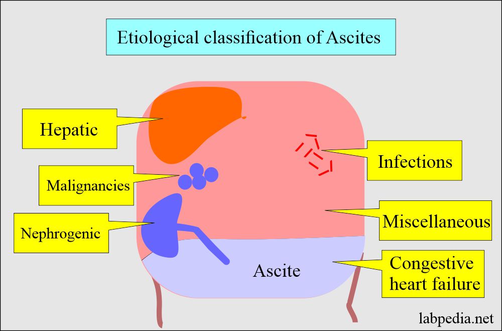 Ascitic fluid in Various Diseases: Ascites etiological classification