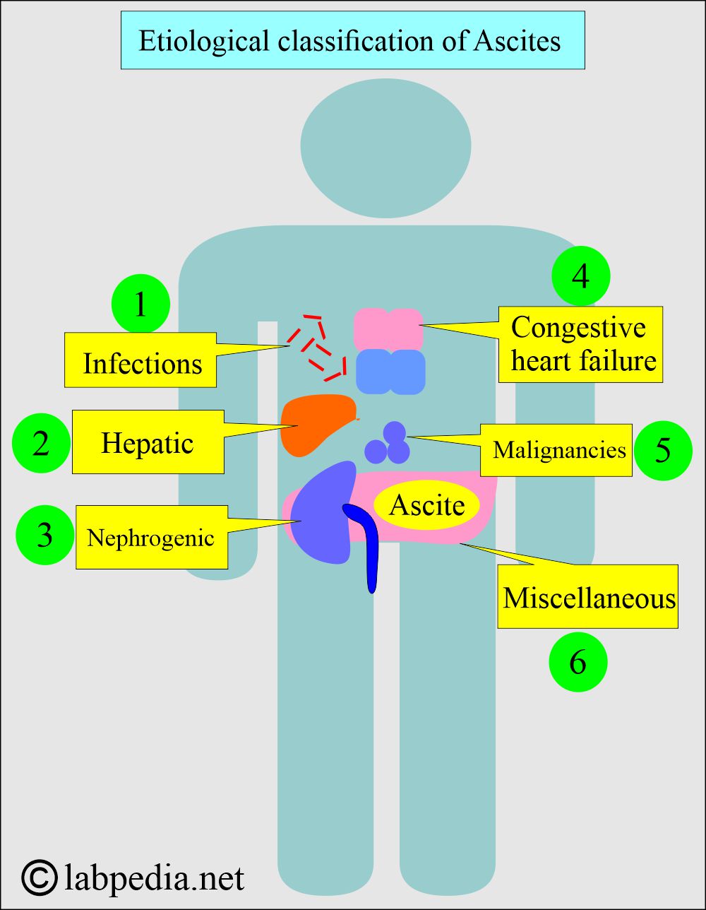 Ascites classification