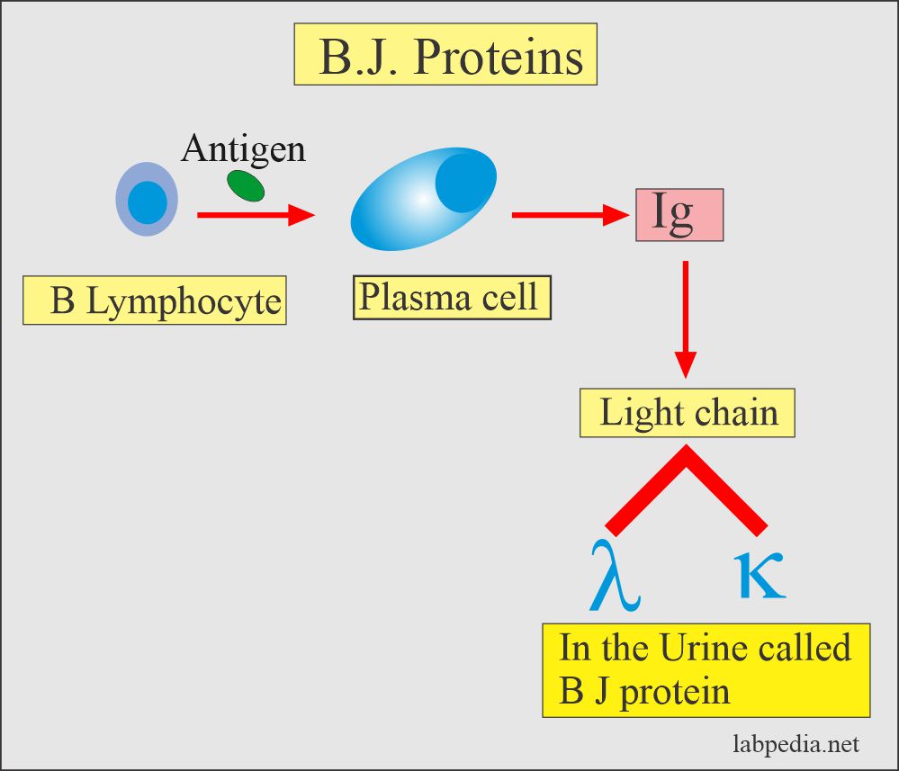 Bence Jones protein formation