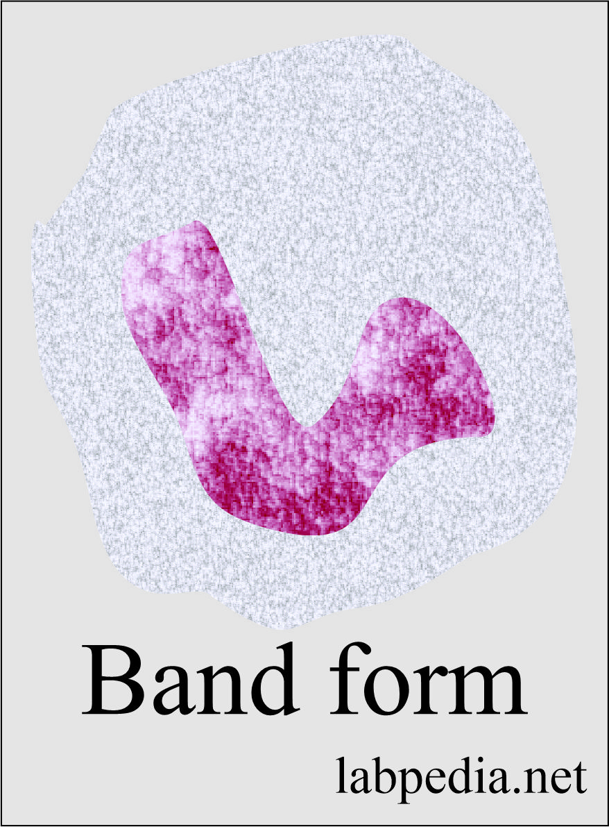 Band form poly