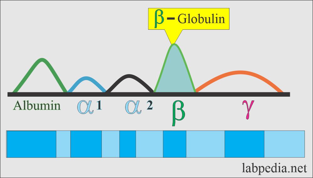 Serum Protein Electrophoresis: Beta-Globulin on electrophoresis
