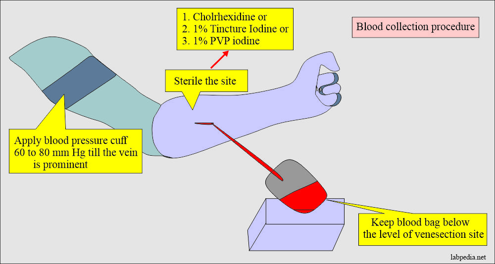Blood banking:- part 3 – Blood Donation Procedure, Blood Components and Their Indications