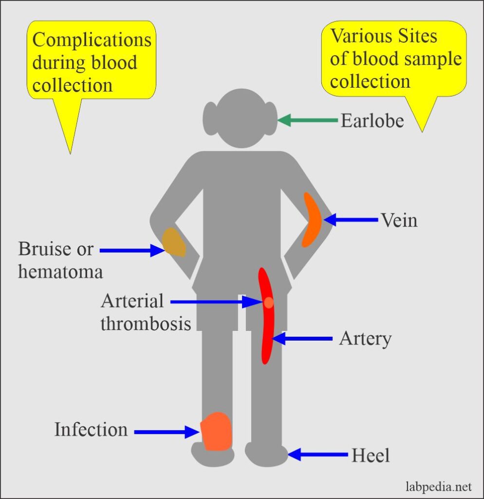 Complications during blood collection and Treatment