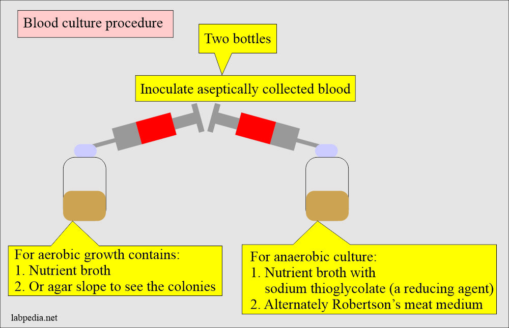 Blood culture procedure