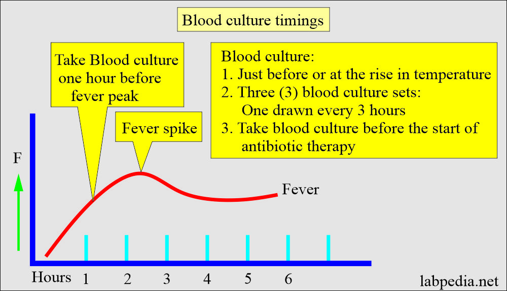 Blood culture sample timing