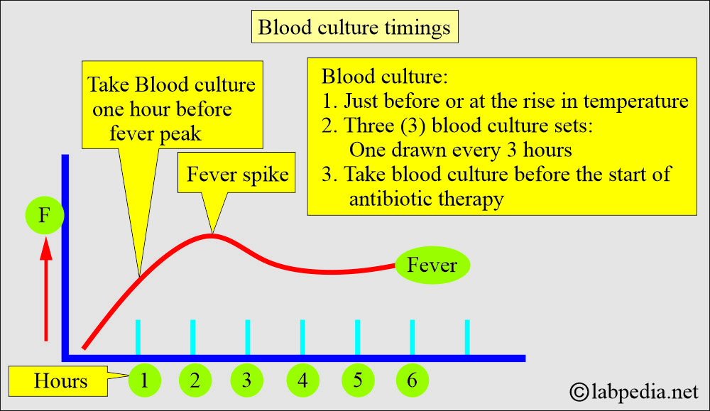 Blood culture when to take sample