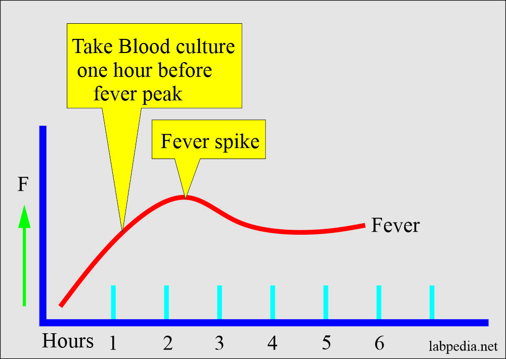 Blood culture sample best time