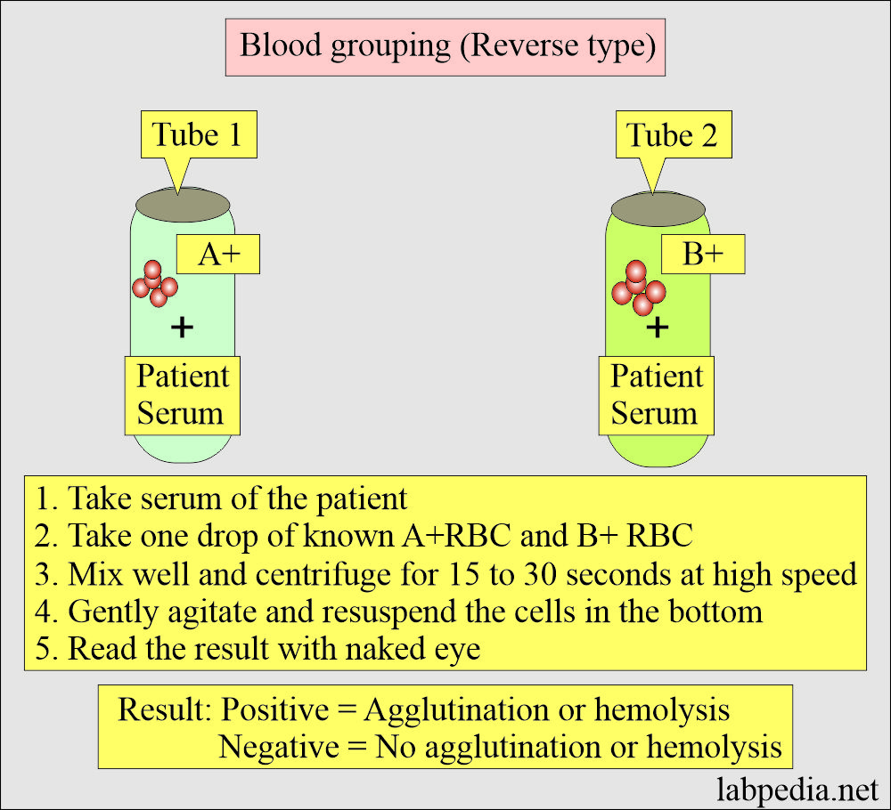 Blood grouping minor procedure