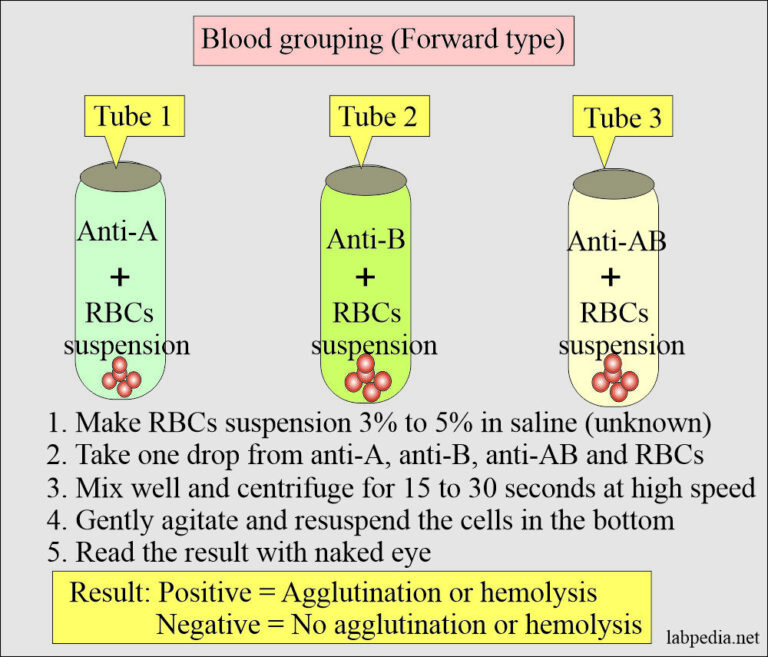 Blood Banking:- Part 1- Blood Groups ABO And Rh System, Blood Grouping ...