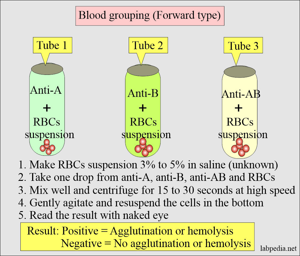 Blood grouping forward type
