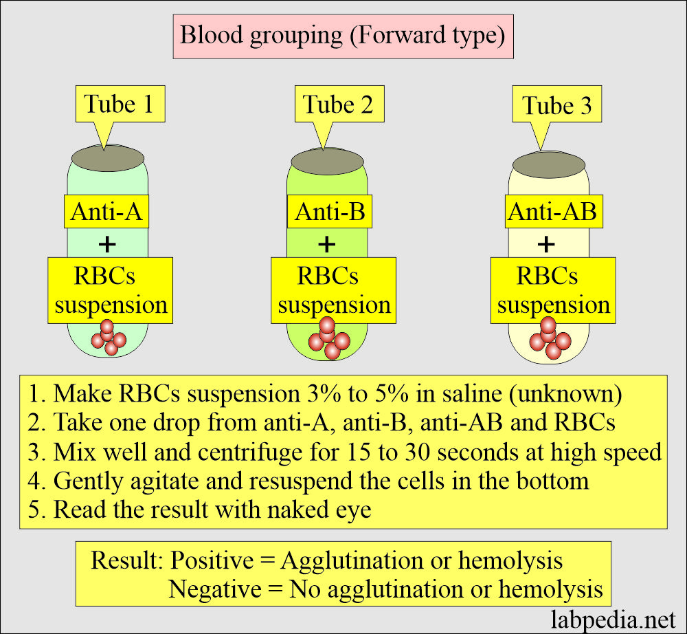 Blood grouping forward type
