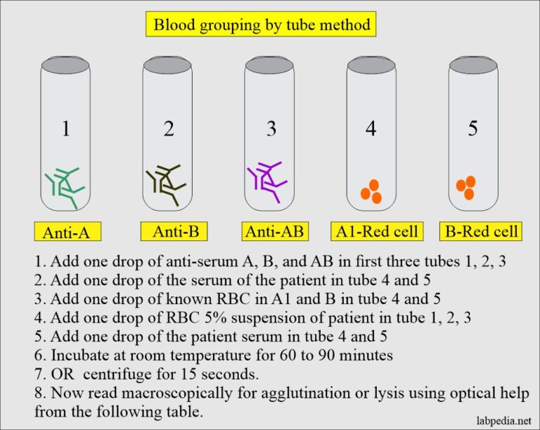 Blood Banking:- Part 1- Blood Groups ABO And Rh System, Blood Grouping ...