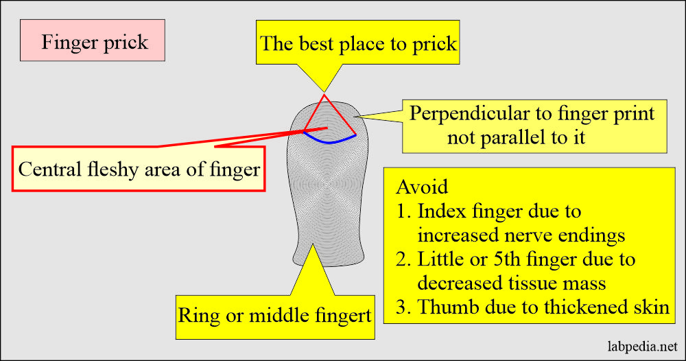 How to Handle Various Specimens: Blood sample finger prick